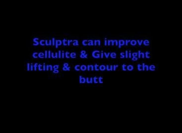 Sculptra Butt Lift