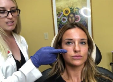 Facial Contouring with Restylane Lyft