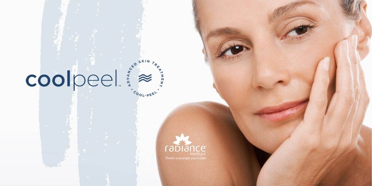 CoolPeel Laser Treatment Avon CT