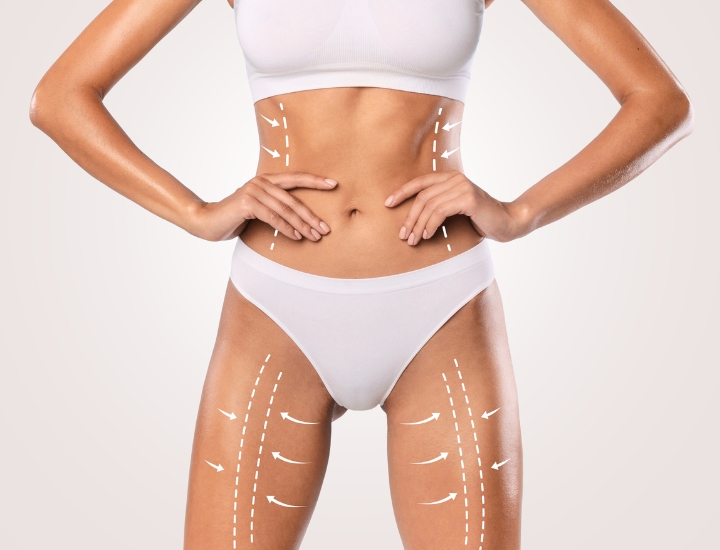 body-sculpting-treatments-in-avon1-06 body-sculpting-treatments-in-avon1-06