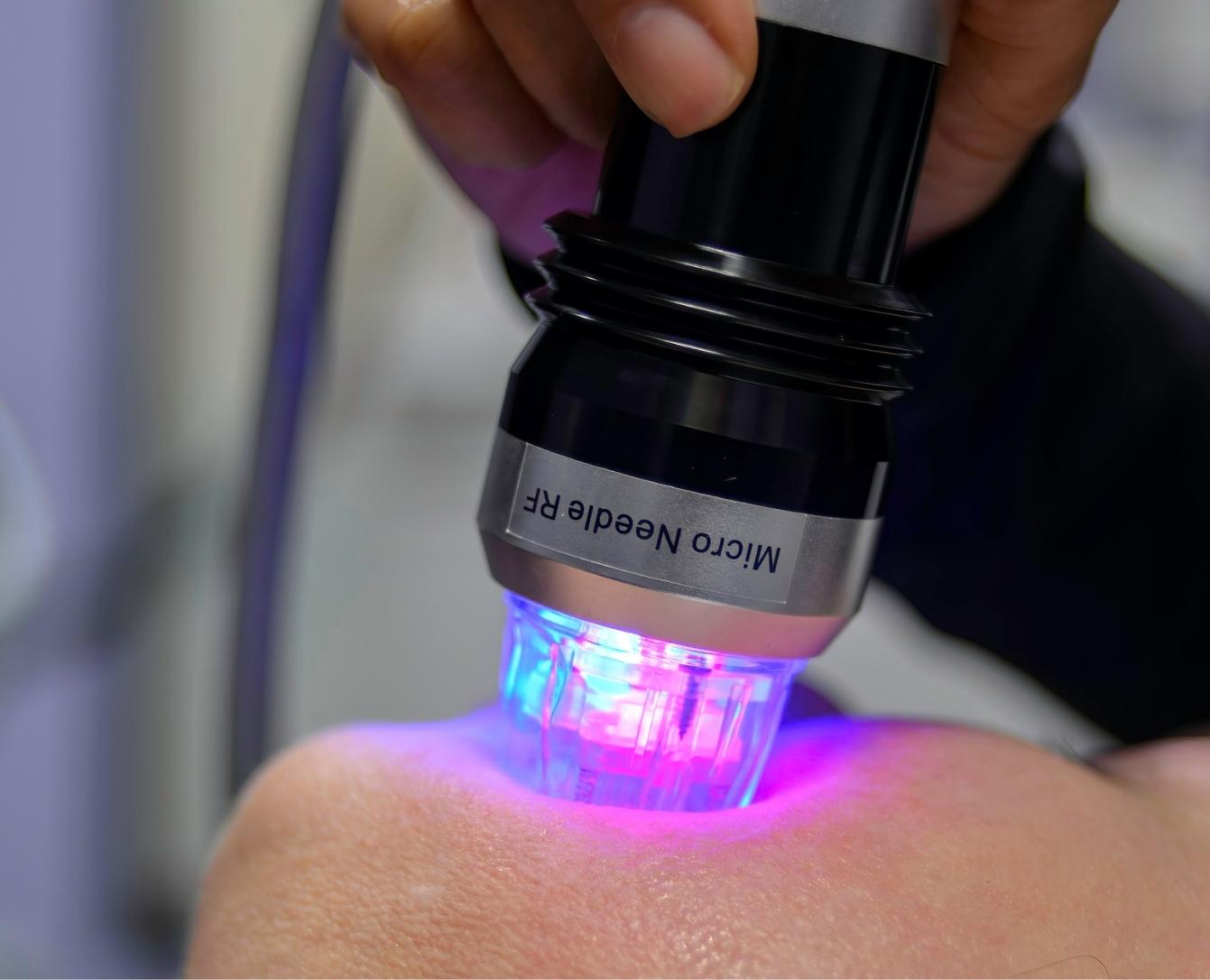Microneedling Treatments Hartford CT microneedling treatments hartford ct